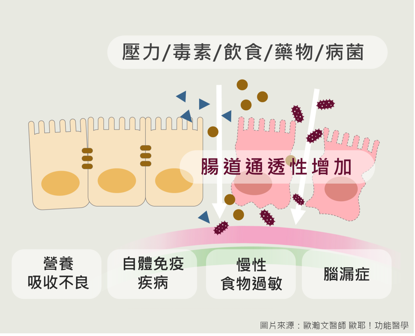 腸漏症與多種可能會傷害腸道黏膜的原因息息相關