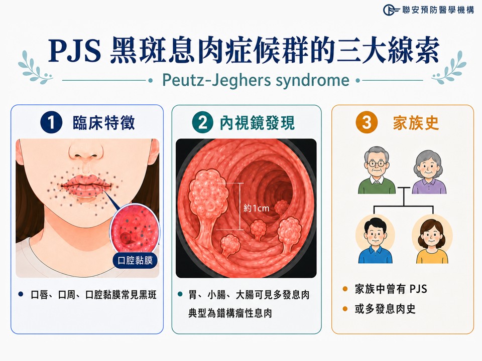 PJS黑斑息肉症候群的三大線索